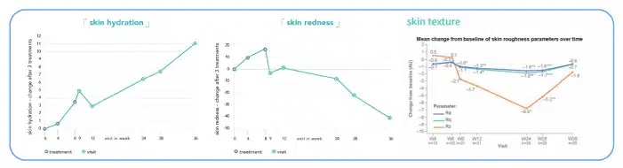 ผลลัพธ์หลังฉีด Belotero Revive