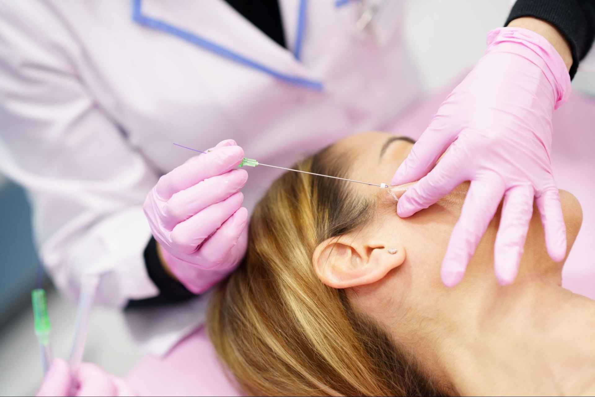 ร้อยไหม คืออะไร ช่วยอะไร